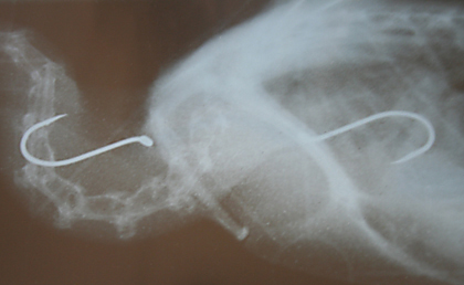 X-Ray of Black faced cormorant with two hooks